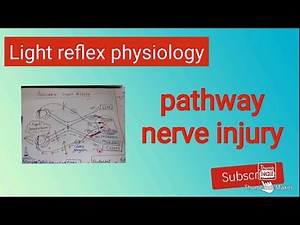 Pupillary Light reflex pathway and nerve injury