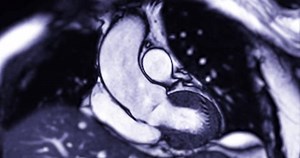 Усовершенствованный МРТ-тест с сердечным стрессом выявляет: стоковое видео (без лицензионных платежей), 3858779245 | Shutterstock