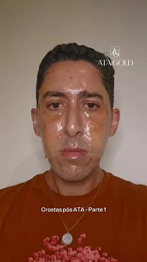 Transformação Completa: Protocolo Concluído na Primeira Etapa