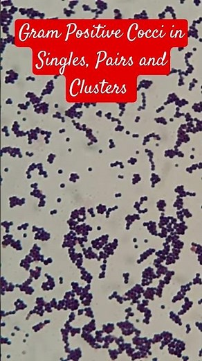 Gram Positive cocci in singles, pairs and clusters of Staphylococcus epidermidis
