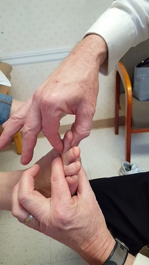 Clinical Tests for Plantar Plate Tears This video descibes four tests that can be used in the clinical setting to help diagnose plantar plate tears. All four of these tests can easily be performed by the clinician in about 1-2 minutes during the examination of the patient. These four clinical tests give the clinician a very good indication of whether a plantar plate tear is present and how severe the plantar plate tear may be. The Dorsal Drawer Test, first described by Thompson and Hamilton in 1