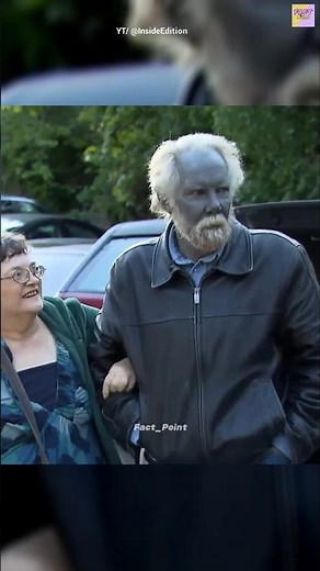 How Did Paul Karason’s Body Turn Blue? The Science Explained! #facts #trending