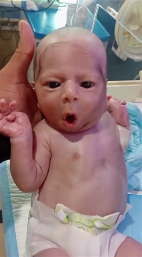 CUTE ANGEL 👼 #neonatal #baby #100kviews #foryoupagе
