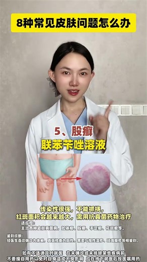 8 Essential Skin Diseases Explained by a Doctor