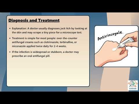 Tinea Cruris (Jock Itch) Explained Causes, Symptoms and Treatment, All Insights