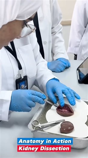 ‎مدرسة الصلت بن مالك الخاصة SBM‎ on Instagram‎: "استكشف طلبة الصف الثاني عشر ثنائي اللغة تركيب الكلية ووظائفها في حصة عملية تفاعلية، شملَت تشريح الكلية ودراسة أجزائها واستخدام تطبيقات رقمية لفهم آلية عملها، مما عزز استيعابهم للمفاهيم العلمية بطريقة ممتعة ومباشرة"‎