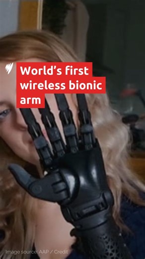 After four years in the making, a UK bionics company has unveiled the world’s first-ever wireless bionic arm — and 19-year-old influencer Tilly Lockey isn’t just wearing it, she helped design it. Tilly, a bilateral amputee, is now the proud owner of the ground-breaking prosthetic she helped bring to life. For the latest news, visit: https://ow.ly/Pf4s50VEglI | SBS News