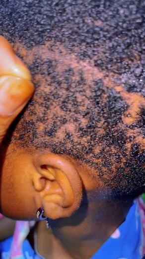Scalp and Ear Examination: Hair Care Tips