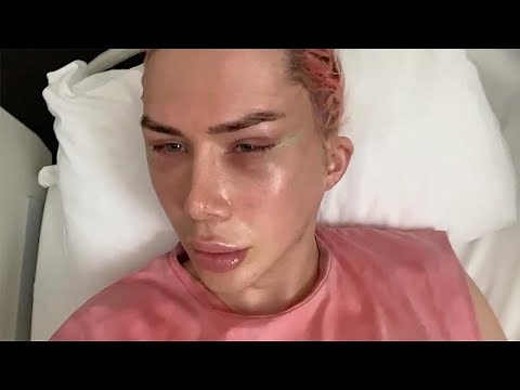 Man Spends Over £150K On Plastic Surgery To Look Korean