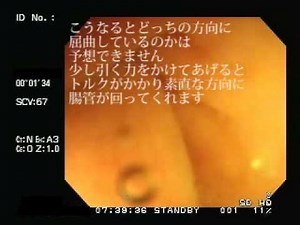 大腸内視鏡検査 TypeC No.7 Colonoscopy