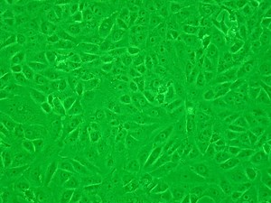 Vero cell - Alchetron, The Free Social Encyclopedia