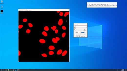 Fiji ImageJ 第5讲——二维图像的细胞计数