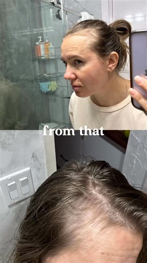 What will your hair look like in 3 months? Our formula has clinically validated keratin and more to deliver thicker, shinier and stronger hair and support a healthy hair growth cycle in 3 months. | Ancient Nutrition