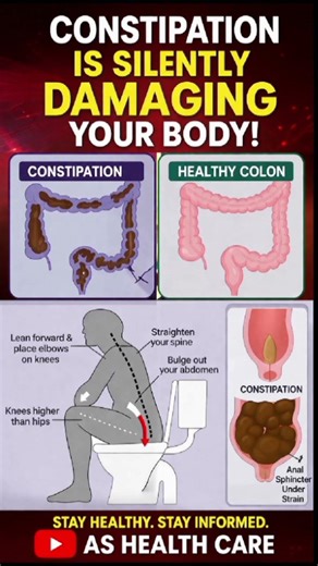 Constipation Is Slowly Damaging Your Body 😱 Fix It NOW!#digestivehealth #digestivesystem #shorts