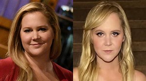 Amy Schumer Poses in Minidress in New Photos After Weight Loss Journey