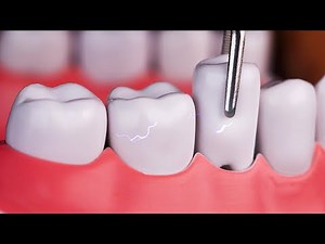 [Sub] ASMR🦷 Your sore teeth get better😲