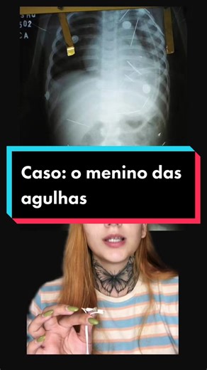 Vcs já conheciam esse caso? #casoomeninodasagulhas #omeninodasagulhas #casosbrasileiros #casoscriminais