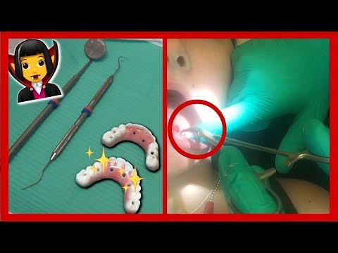 I GOT PERMANENT FANG IMPLANTS | Bethany Wilhelm