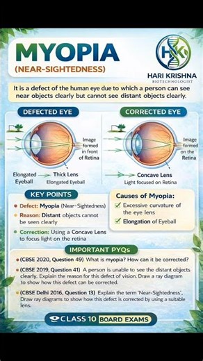 Class 10 Science | Myopia | Ray Diagram & Correction 🔥 #class10 #myopia #importantquestions