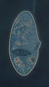 Cell's death | Biologie Biology