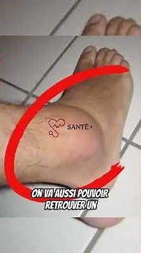 Entorse de la cheville : Causes, symptômes et récupération rapide 🦶