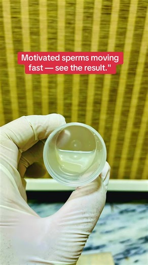 23 year old male semen analysis#semenanalysis #fertilityawareness #fertility #experiment #viral