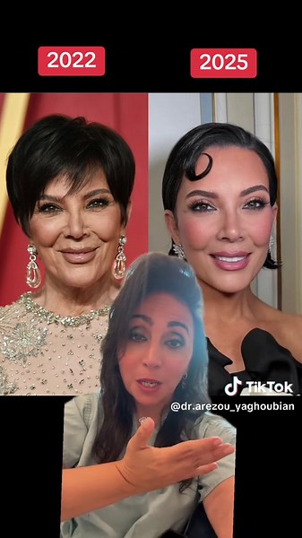 Kris Jenner’s Stunning Plastic Surgery Transformation