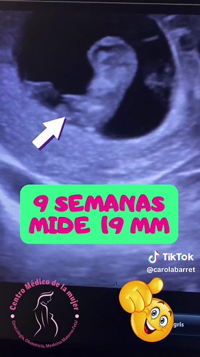 #ecografiaobstetrico #ecografiaembarazada #ecografiaembarazado #embarazo #embarazosemanaasemana #embarazosaludable #embarazada #embarazadafeliz #embarazadasprimerizas #embarazadas #embarazadastiktok