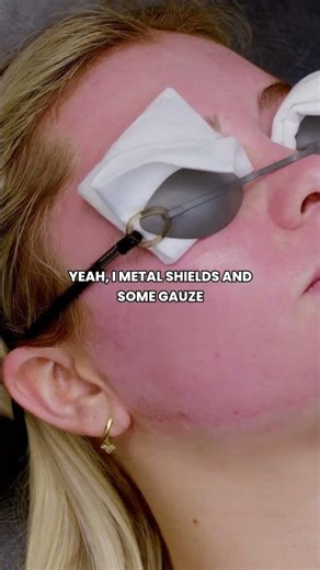 1927 Laser Demo | with Dr. Kesty