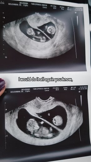 2.5K views · 7.1K reactions | Happy 2nd Birthday to our precious...