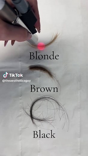 Understanding Laser Hair Removal and Hair Color