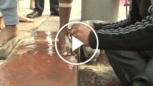 The Doctor With a Razor Blade in India