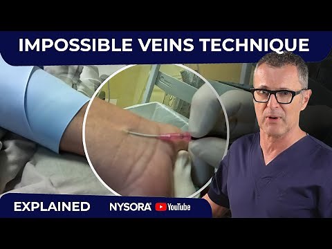 Difficult veins - Made Much Easier with this technique!