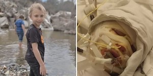 Prescott boy badly burned after accidental bonfire explosion