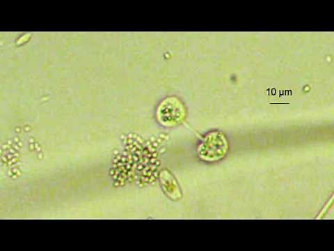 amoeba dividing (prob. Cochliopodium)