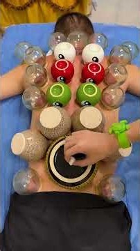 💈Cupping therapy!