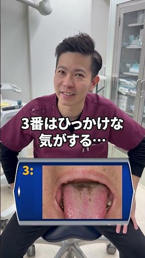 Which of the following is tongue cancer? #tonguecancer #stomatitis #cancer