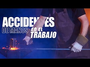 💥💥 ACCIDENTES DE MANOS EN EL TRABAJO | POR QUÉ OCURREN? | CONSEJOS DE CÓMO ACTUAR CORRECTAMENTE 🖐️