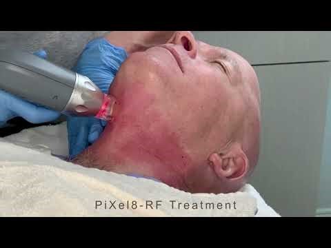 Dr. Jordan's PiXel8-RF Experience