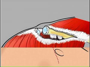 Open Weaver Dunn Animation 01