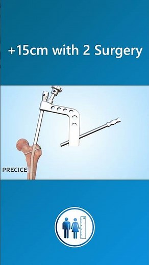 How is limb lengthening surgery performed with Precice 2?