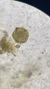 Copro directo 🔬🩸🦠 #fypシ゚viralシ #fypviralシ #fypシ゚ #laboratorio #paratiiiiiiiiiiiiiiiiiiiiiiiiiiiiiii #virales #laboratory #nurse | Naun Toledo Parra