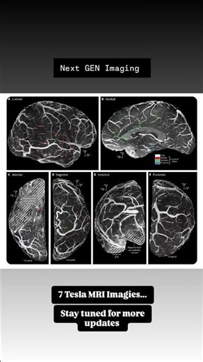 7T MRI Imagies of the brain.PC: Science Magazine #brainmri #neuroimaging #mri #mritech #mrisoftware