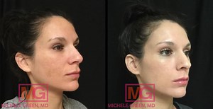 Options for Skin Lightening - Dr. Michele Green M.D.