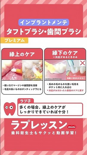 【ラプレッスンmini】インプラントケア編 〜タフトブラシ・歯間ブラシ〜