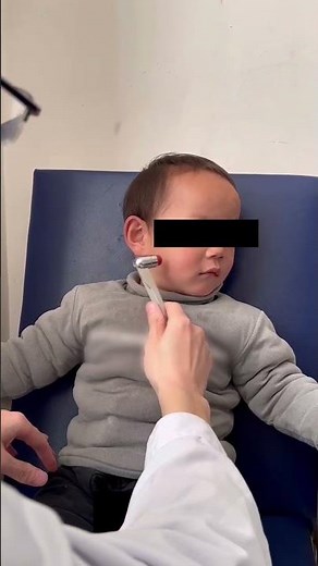 Images in Clinical Medicine: Chvostek’s Sign in Familial Hypoparathyroidism