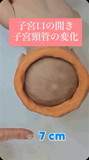 子宮口が開いてくると子宮頸管は短くなっていきます。 子宮口が10cmまで開いたら、赤ちゃんが産まれてくるよ！ 助産師学生、新人助産師の内診イメージにおすすめな動画です！ As the cervix opens, the cervix shortens. When the cervix opens to 10 cm, the baby will be born! This video is recommended for midwifery students and new midwives for internal examination images! #子宮口 #子宮頸管 #子宮 #出産 #赤ちゃん #新生児 #助産師 #助産師学生 #新人助産師 #内診 #cervix #cervix #uterus #birth. #baby #newborn #midwives #midwifery #midwiferystudent | Rin Shimokawa