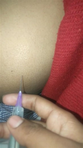 im injection