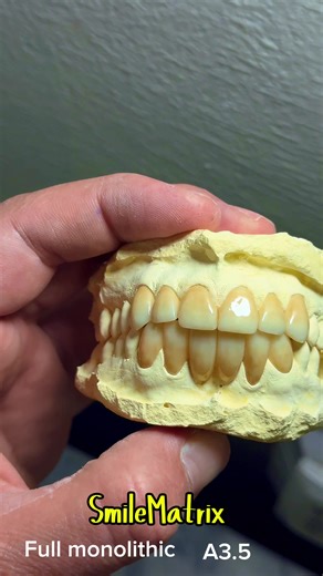 #CapCut #zirconiumcrowns #unfrezzmyaccount #ksa🇸🇦 #repost @Dr-shah-sab 🩺🦷 @MR 🔰Z @ROGHANii___BADMASH👹😜 @Muhammad zayyan @JaHaنGiR_KhAن🇬🇧 @khalid Pakhtoon @Dr Farhan Malik 🦷 @islamabad Dental clinic 🩺💊💉 @Rawalpindi Queen 👑🇵🇰❤️