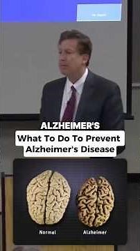The REAL Way To Prevent Alzheimer’s?
